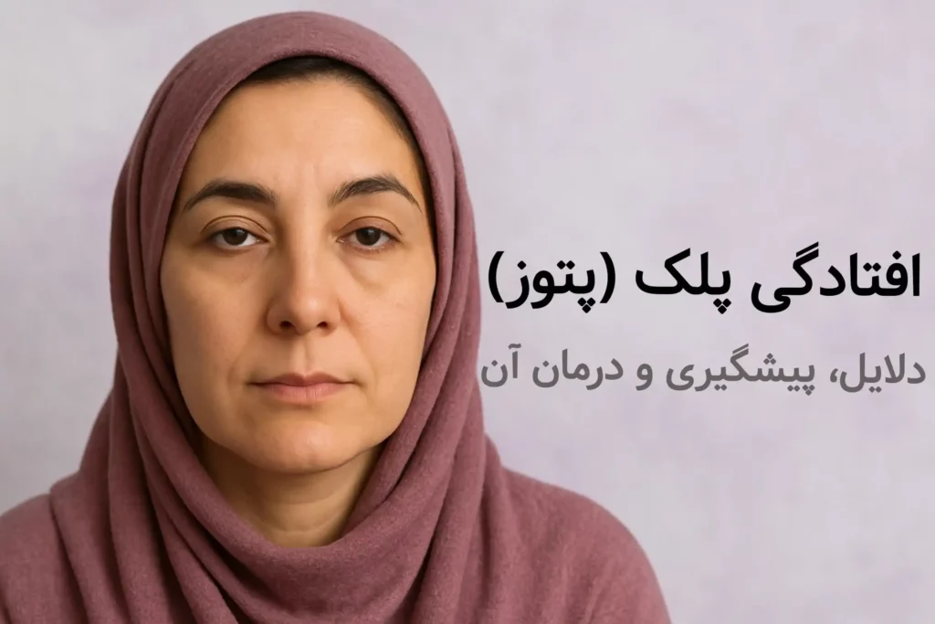 افتادگی پلک + 4 روش پیشگیری و درمان 1 خانمی که دچار افتادگی پلک (پتوز) هست.