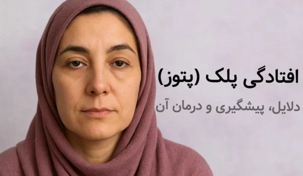 خانمی که دچار افتادگی پلک (پتوز) هست.