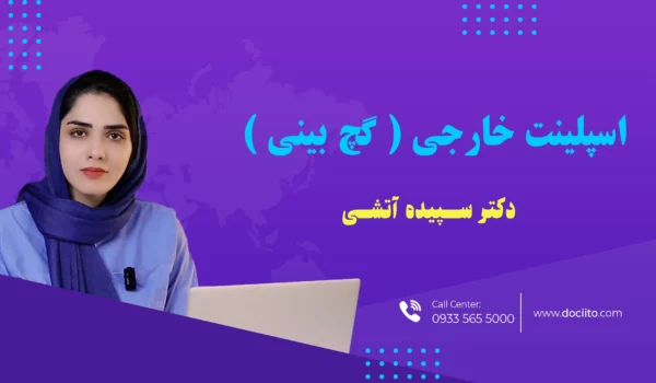 اسپلینت خارجی یا کچ بینی