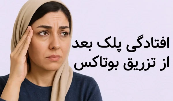 افتادگی پلک بعد از تزریق بوتاکس
