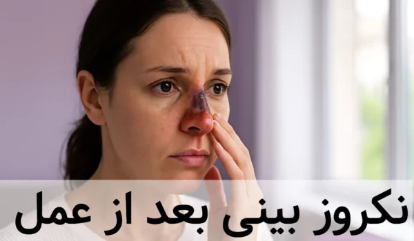 نکروز بینی بعد از عمل {از علائم تا درمان) 1 خانمی که دچار نکروز بینی بعد از عمل شده است.