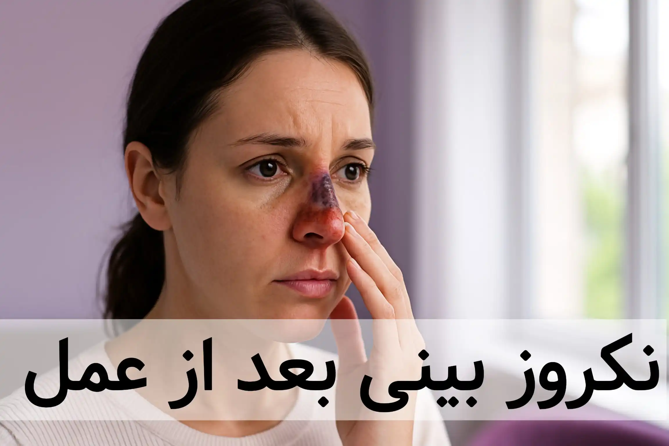 خانمی که دچار نکروز بینی بعد از عمل شده است.